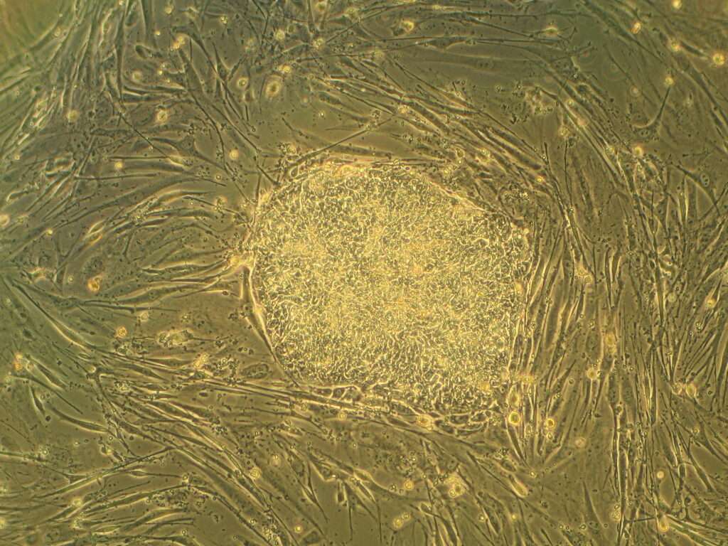 “SUST-STAM”, il progetto di ricerca su medicina rigenerativa e staminali tra Italia e Svizzera; «SUST-STAM», le projet de recherche sur la médecine régénérative et les cellules souches entre l'Italie et la Suisse (c) Public domain, Ryddragyn, Wikimedia Commons